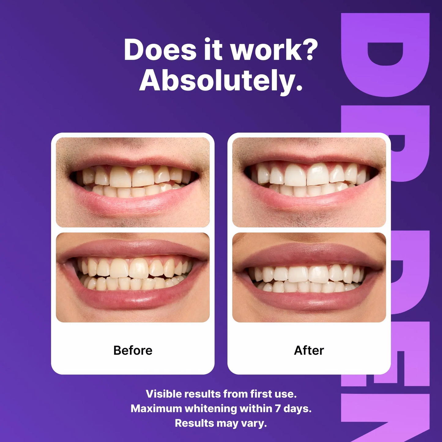 Purple Teeth Whitening Strips – Enamel Safe & Peroxide-Free Whitening