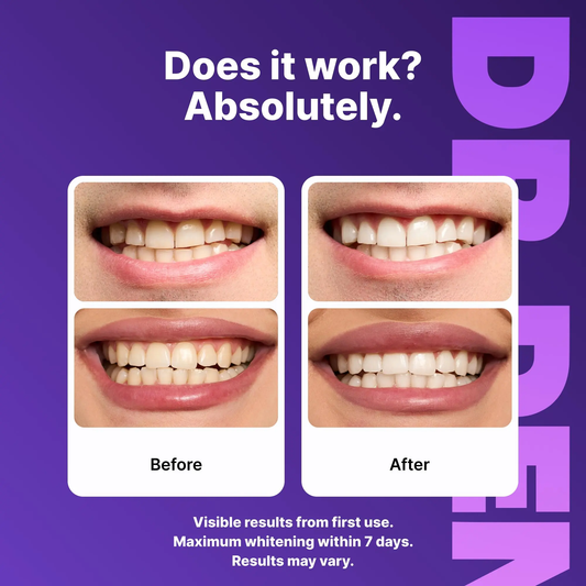 Purple Teeth Whitening Strips – Enamel Safe & Peroxide-Free Whitening